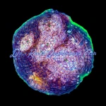 Acan - Hypershock